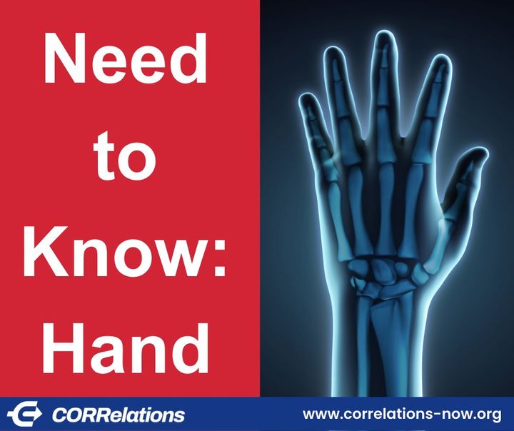 Screws Cost Less Than K-wires for Metacarpal and Phalangeal Fractures