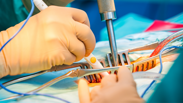 Use “Baby Bear” Pedicle Screws in Spinal Deformity Surgery