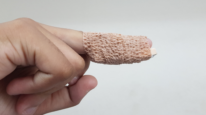 Long-term Non-op Care for Mallet Finger Fractures Looks Good