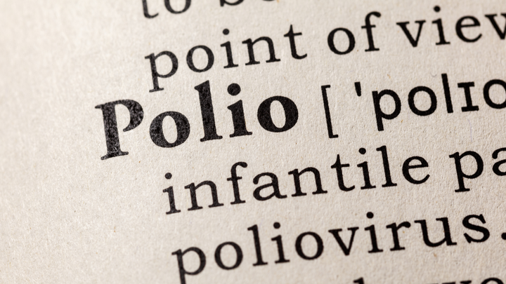 A Cautionary Case Series — TKA After Polio