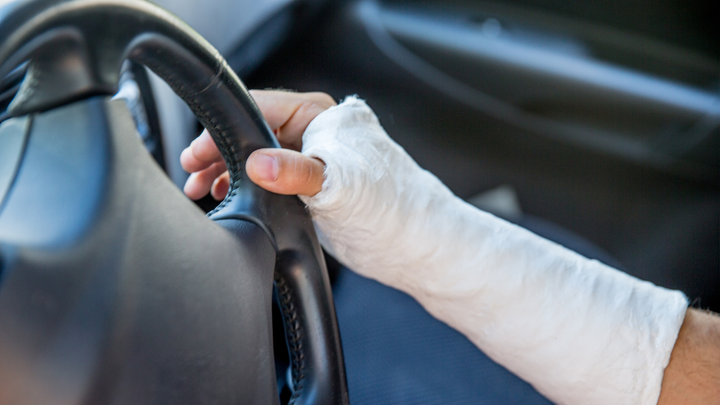 Patients Drive Early After Hand Surgery, but is it Smart?