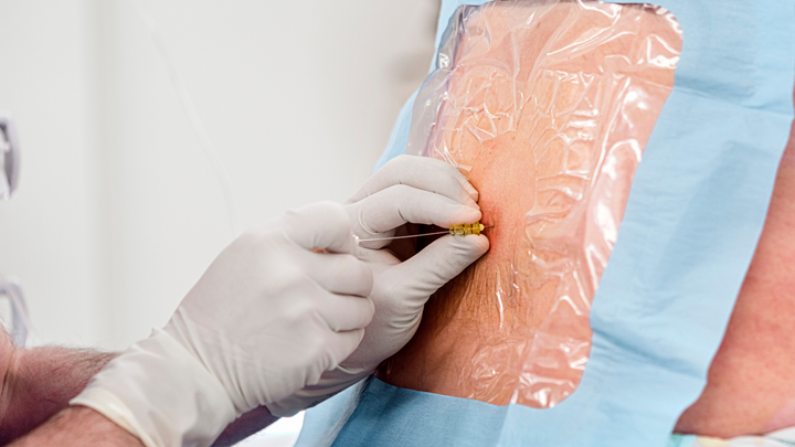 What You Can (and Can’t) Learn from Pre-op Lumbar Injections