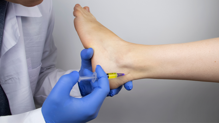 RCT on PRP for Ankle OA, and Its Predictable Fallout