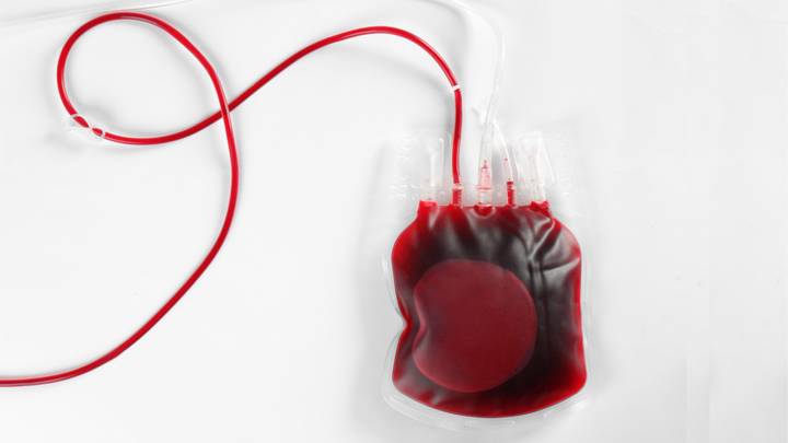 When to Pull the Transfusion Trigger After Ortho Trauma Surgery